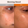 image:imageBLITHE Niacinamide 5  TXA Tranexamic Acid 3 Serum Dark Spot Corrector  Vitamin B3 Niacinamide for Face Skin Soothing Cica amp Allantoin Arbutin amp Tranexamic Acid 1oz