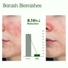 image:imageBLITHE Patting Splash Mask Soothing amp Healing Green Tea  Lactic Acid Face Exfoliator Wash for Sensitive Skin Vegan K Beauty Oil Controlling amp Pore Clarifying 23 Fl OzSoothing  Healing Green Tea