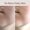 image:imageBLITHE Pressed Serum Crystal Iceplant Face Moisturizing Gel  Kbeauty Best Skin Cream for Dry Skin Korean Serum for Combination Skin amp Redness Relief Face Moisturizer for Dry Skin Cream 168 OzVelvet Yam